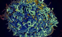 درمان کامل HIV با روش «شوک و کشتن»