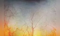 چشم انسان از نمای نزدیک
