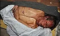 جسد قذافی کالبد شکافی شد/عکس 18 +