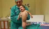 دختری با سندرم پری دریایی!/عکس