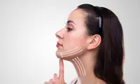 انواع لیفت صورت | بررسی روش‌های مختلف لیفت صورت + جدول مقایسه