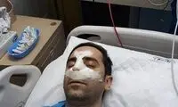 خطیر تحت عمل جراحی قرار گرفت