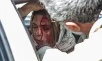 اولین عکس گوهر خیراندیش پس از تصادف