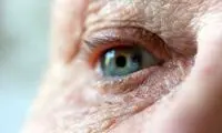 تشخیص زودهنگام آلزایمر با معاینه چشم