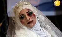 عروس‌هایِ فلسطینی با سر و صورت کبود