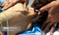 وضعیت ابوالفضل 2 ساله پس از شکنجه ناپدری