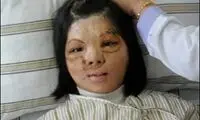 شیوه جدید چینی‌ها برای پیوند صورت +عکس
