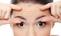 عاملان و قاتلان چین و چروک
