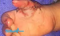 عمل جراحی شگفت آور روی دختر بچه ۲ ساله!