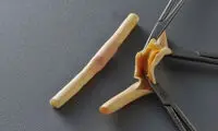 رگ مصنوعی رونمایی شد
