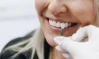 بهترین کلینیک کامپوزیت ونیر دندان در تهران؛ معرفی ۱۰ مرکز