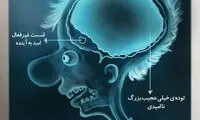 کاریکاتور؛ اسکن مغزی یک ایرانی در شرایط کنونی
