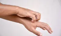 ۷ دلیل خارش شدید پوست
