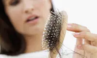 چرا موهام می‌ریزه؟