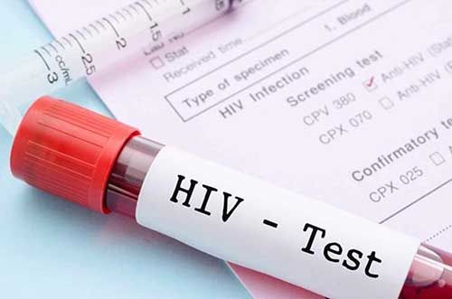 سرکوب HIV با یک روش جدید