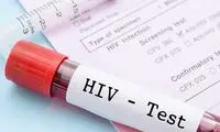 سرکوب HIV با یک روش جدید