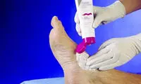 بهترين مرطوب‌ کننده‌ ها براي ديابتي‌ ها