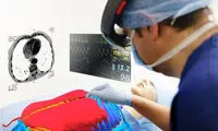 جراحی سرطان روده با عینک واقعیت افزوده