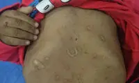 ستایشی دیگر، این بار قربانی توحش والدین! (18+)