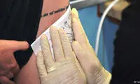 خطر خالکوبی، از احتمال بروز آلرژی تا سرطان