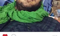 سرانجام شایعه مرگ علی ضیا در منا +عکس