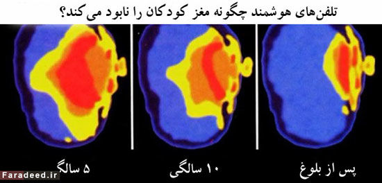 تبلت چگونه مغز کودکان را نابود می‌کند؟