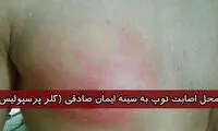 عکس: محل برخورد توپ به سینه صادقی