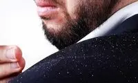 با یکی از موثرترین شامپوهای ضدشوره آشنا شوید