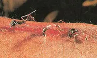 مورچه‎های حیرت انگیز که جراحی می‎کنند