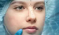 جراحی زیبایی بینی؛ بله یا خیر؟