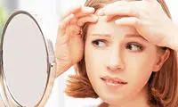 توصیه هایی برای کنترل آکنه
