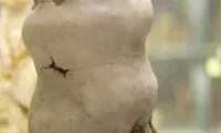 پسری با دو سر روی هم! +عکس