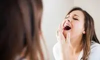 برای داشتن دندان سالم این خوراکی‌ها را نخورید