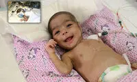 خارج کردن توده از قلب نوزاد سه ماهه