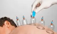 دانستنی‌هایی درباره حجامت