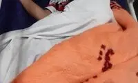 عکس یک کودک آسیب‌دیده بعد از حمله مسلحانه