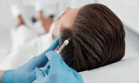 بررسی تفاوت فیلر مو با مزوتراپی | کدام روش بهتر است؟