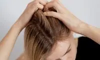 خارش سر ناشی از کمبود چه ویتامینی است؟