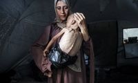 تصویر دردناک از یک کودک گرسنه در غزه