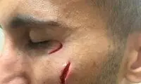 تصویری از مصدومیت وحشتناک دروازه‌بان چادرملو! 