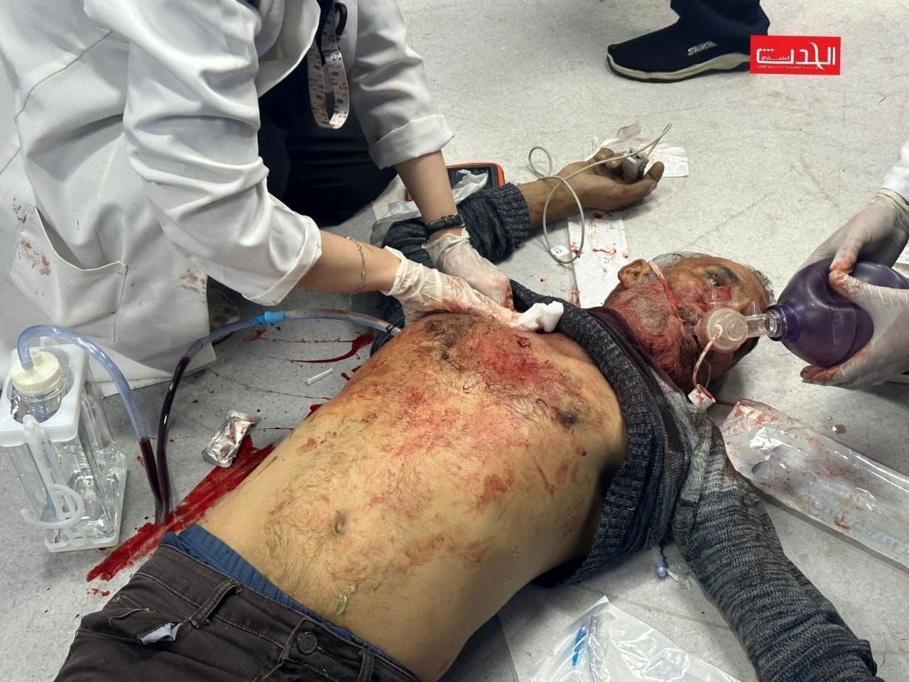 تصاویر دردناک و دلخراش از حمله به بیمارستان غزه