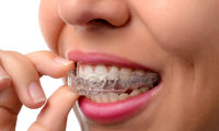 ارتودنسی اقساطی چیست و چه مزایایی دارد؟