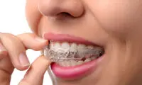 ارتودنسی اقساطی در تهران چه مزایایی دارد؟