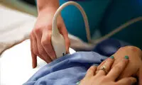 10 علامت که نشان می‌دهد شما باردار شده‌اید
