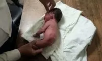 تولد یک نوزاد عجیب‌الخلقه که به جای پا، دُم‌ دارد