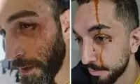  خون و خونریزی در یک سالن والیبال در گرگان