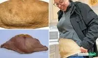 حرکت جنجالی یک زن؛ رونمایی از تبدیل پوست شکم به چرم انسانی!