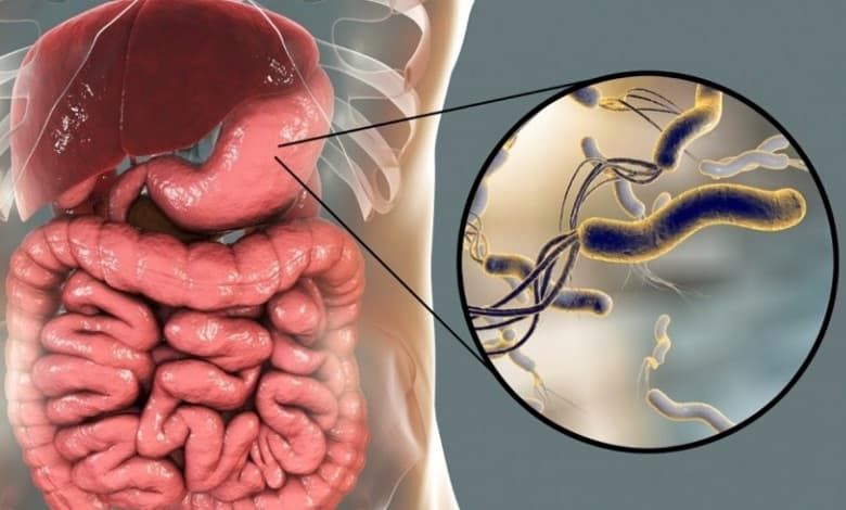درمان هلیکوباکتر پیلوری چگونه است؟ علاﺋم و راه‌های تشخیص 