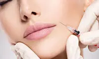 بهترین دکتر تزریق ژل لب روسی در تهران کیست؟ + لیست 10 پزشک برتر