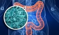 سرطان روده بزرگ چه کسانی را هدف می‌گیرد؟